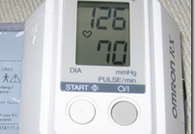 Hipertension arterial varia segun la edad Hipertension arterial varia segun la edad