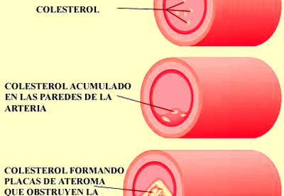 Consejos a tener en cuenta sobre el colesterol Consejos a tener en cuenta sobre el colesterol
