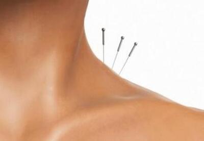 Acupuntura para reducir el dolor menstrual Acupuntura para reducir el dolor menstrual