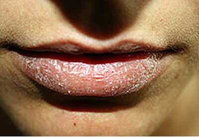 Para darles un buen trato a los labios Para darles un buen trato a los labios