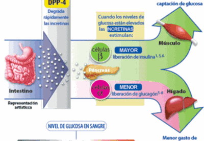 Resistencia a la insulina y arterias Resistencia a la insulina y arterias