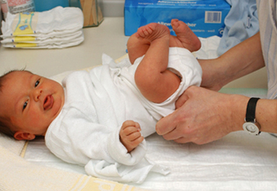 Cómo evitar la pañalitis en los bebés Cómo evitar la pañalitis en los bebés