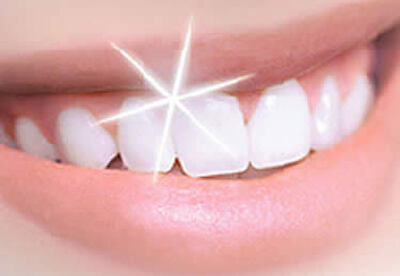 Un truco casero para mantener los dientes siempre blancos Un truco casero para mantener los dientes siempre blancos