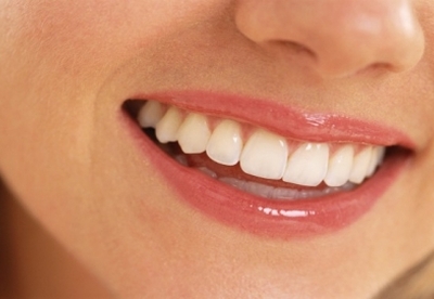 Alimentos para tener una sonrisa saludable Alimentos para tener una sonrisa saludable