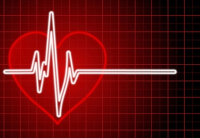 Alimentos para limpiar las arterias Alimentos para limpiar las arterias