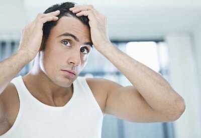 Caída de pelo en hombres jóvenes Caída de pelo en hombres jóvenes