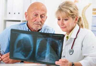 Cáncer de próstata síntomas y cómo prevenir la enfermedad Cáncer de próstata síntomas y cómo prevenir la enfermedad