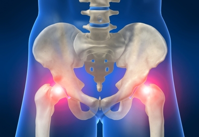 Por qué me duele la cadera Por qué me duele la cadera
