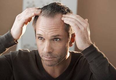 Cebolla para la caída del cabello Cebolla para la caída del cabello