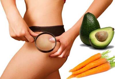Como eliminar las estrías naturalmente Como eliminar las estrías naturalmente