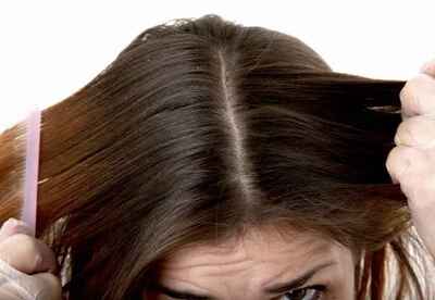 Cómo prevenir la caspa y como tratarla Cómo prevenir la caspa y como tratarla