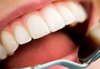 Consejos para combatir la gingivitis (Parte 1) Consejos para combatir la gingivitis (Parte 1)