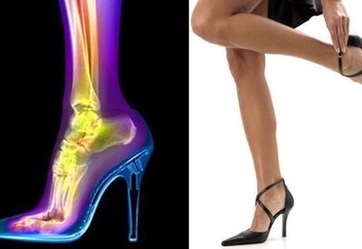Cuando los tacones afectan tu salud Cuando los tacones afectan tu salud