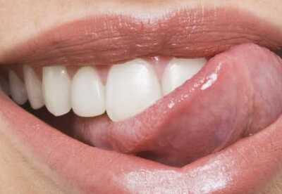 Dolor en la lengua remedios caseros Dolor en la lengua remedios caseros
