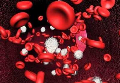 La anemia y el hierro La anemia y el hierro