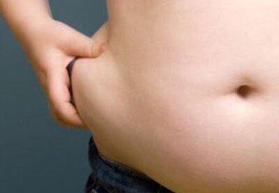 La obesidad como factor de riesgo La obesidad como factor de riesgo