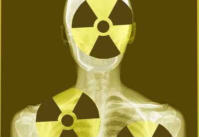 Las radiaciones médicas, en perspectiva Las radiaciones médicas, en perspectiva