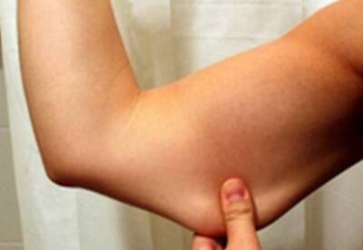 Mesoterapia para adelgazar brazos Mesoterapia para adelgazar brazos