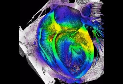 Nanocables de oro mejoran la reparación de los tejidos después de un ataque al corazón Nanocables de oro mejoran la reparación de los tejidos después de un ataque al corazón