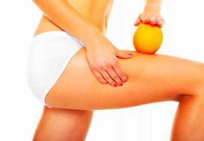Piel de naranja en las piernas Piel de naranja en las piernas