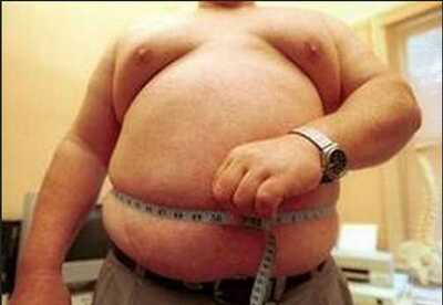 Que es la obesidad mórbida Que es la obesidad mórbida