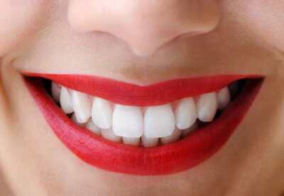 Remedios caseros para blanquear los dientes Remedios caseros para blanquear los dientes