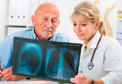 Signos de cáncer de pulmón que no deberías ignorar Signos de cáncer de pulmón que no deberías ignorar
