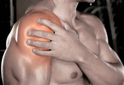 Tendinitis en el hombro como se trata esta condición Tendinitis en el hombro como se trata esta condición