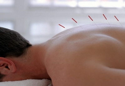 Ventajas y desventajas de la acupuntura Ventajas y desventajas de la acupuntura