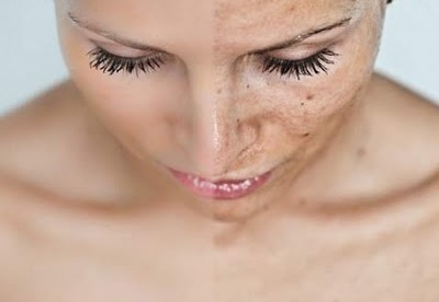 Consejos para aclarar la piel del rostro Consejos para aclarar la piel del rostro