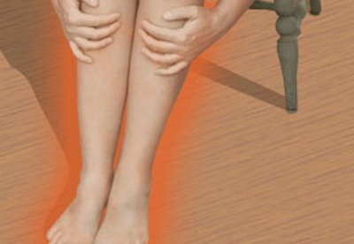 Flebitis| que es Flebitis| que es