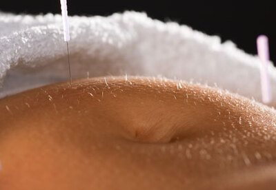 Acupuntura contra dolor menstrual Acupuntura contra dolor menstrual