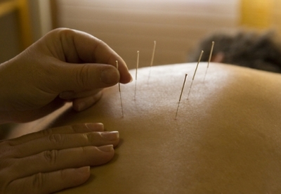 Puntos de acupuntura para bajar de peso Puntos de acupuntura para bajar de peso