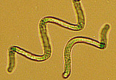 Espirulina para bajar el colesterol Espirulina para bajar el colesterol