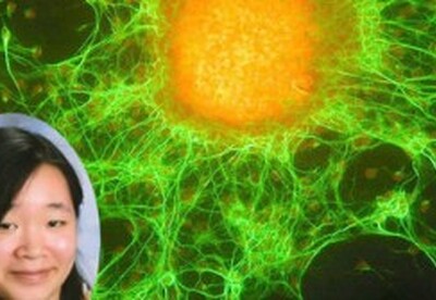Una estudiante de 17 años abre una nueva puerta en la lucha contra el cáncer Una estudiante de 17 años abre una nueva puerta en la lucha contra el cáncer