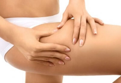 Cómo reducir la celulitis Cómo reducir la celulitis