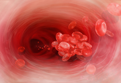 Cómo mejorar la circulación de la sangre Cómo mejorar la circulación de la sangre