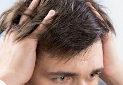 Cómo evitar la caída del cabello Cómo evitar la caída del cabello