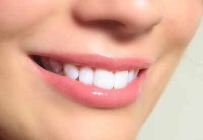 Cuida de tus dientes sensibles Cuida de tus dientes sensibles