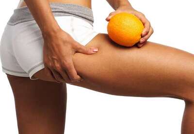 12 Consejos para eliminar la celulitis 12 Consejos para eliminar la celulitis