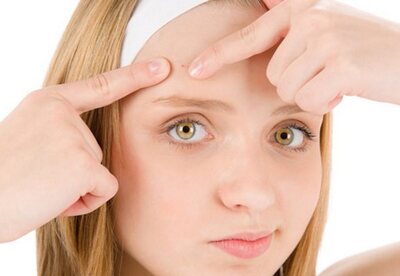10 consejos para prevenir el acné 10 consejos para prevenir el acné