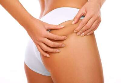 Consejos para reducir la celulitis Consejos para reducir la celulitis