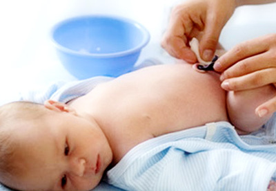 ¿Cómo hacer las curas del cordón umbilical? ¿Cómo hacer las curas del cordón umbilical?