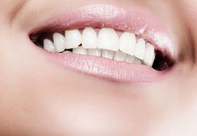Alimentos que dañan los dientes Alimentos que dañan los dientes