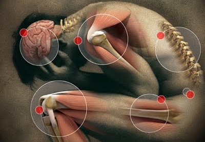 Qué es la Fibromialgia y su tratamiento con alimentos Qué es la Fibromialgia y su tratamiento con alimentos