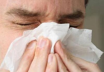 Síntomas de sinusitis Síntomas de sinusitis