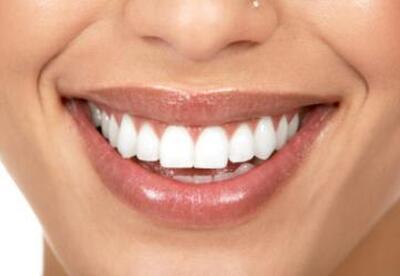 Trucos para tener los dientes blancos Trucos para tener los dientes blancos