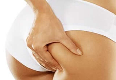 Recomendaciones y la Dieta anticelulitis que debemos consumir Recomendaciones y la Dieta anticelulitis que debemos consumir