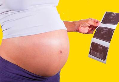 Fecundación in vitro: malos resultados en mujeres con sobrepeso Fecundación in vitro: malos resultados en mujeres con sobrepeso