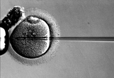 Fecundación ‘in vitro’ Fecundación ‘in vitro’